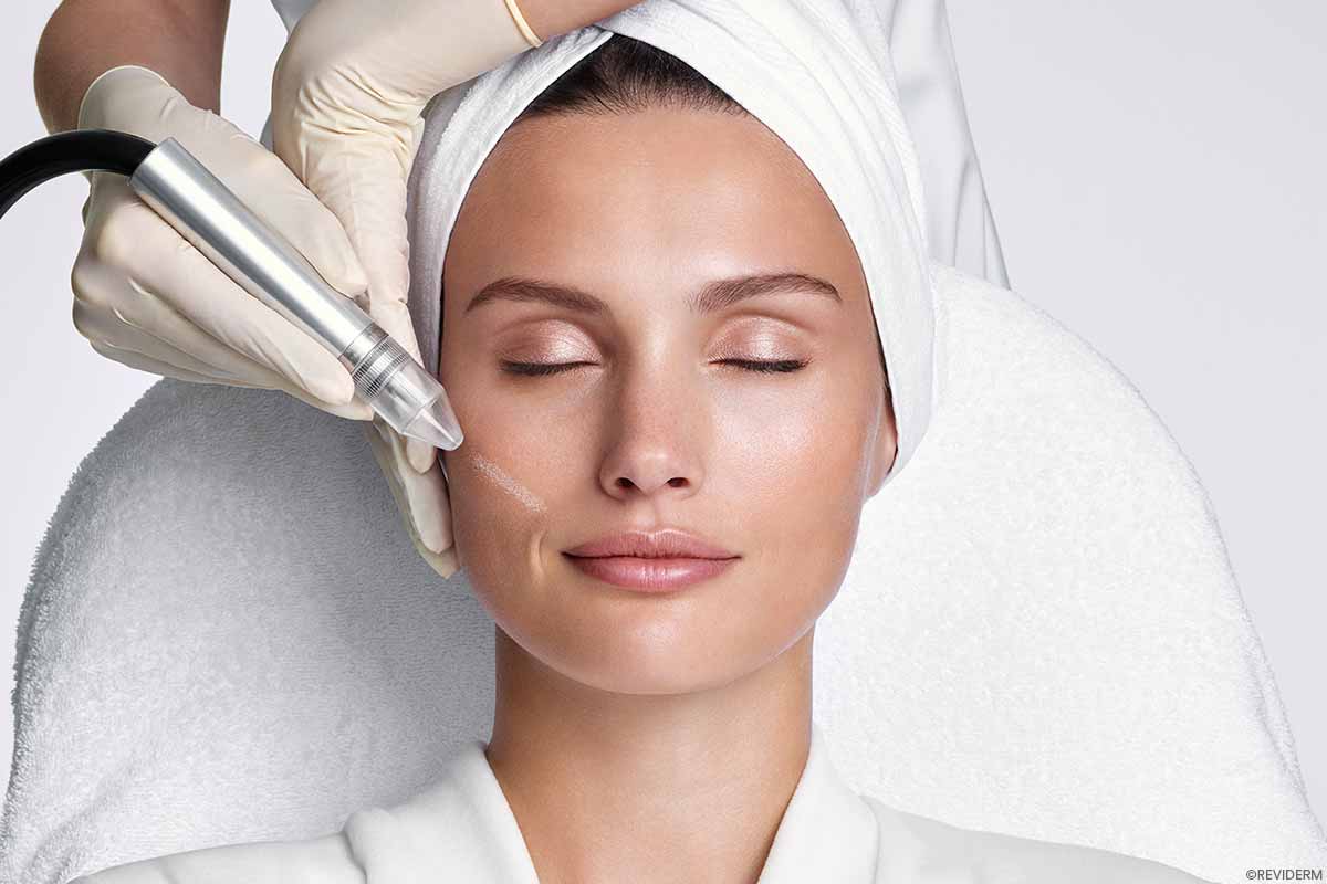 gesichtsbehandlungen mikrodermabrasion